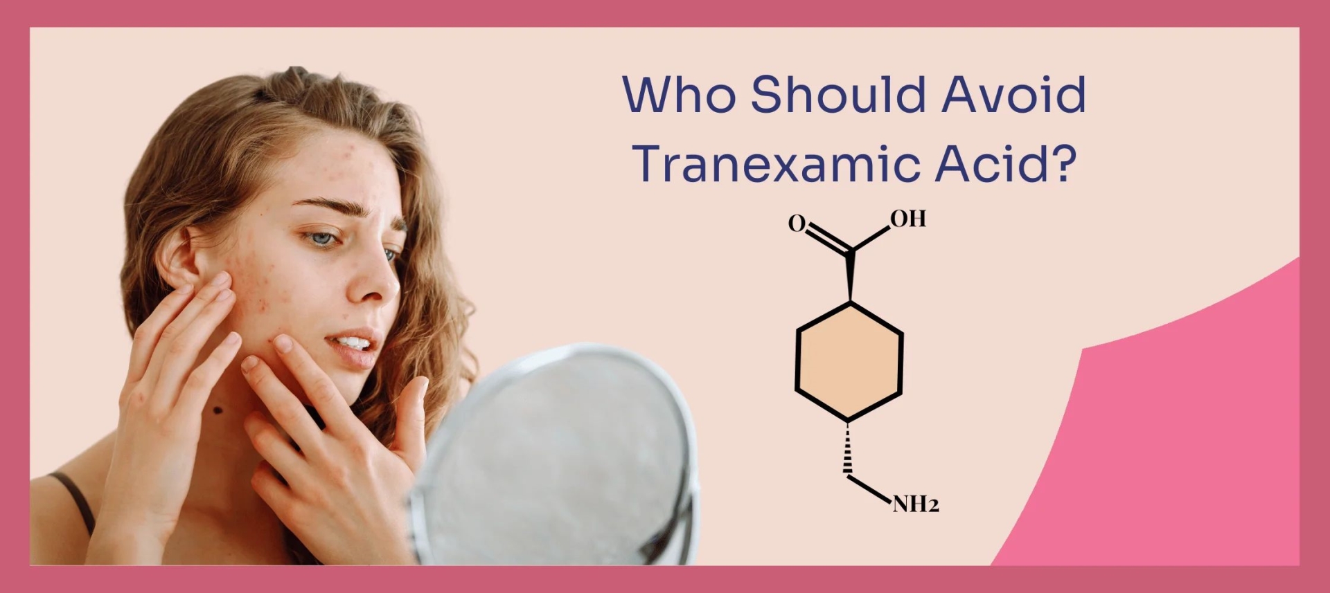 网红“氨甲环酸”被批准用于色斑治疗了吗？